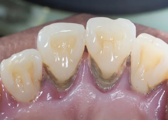 Pg ExaValoracion2