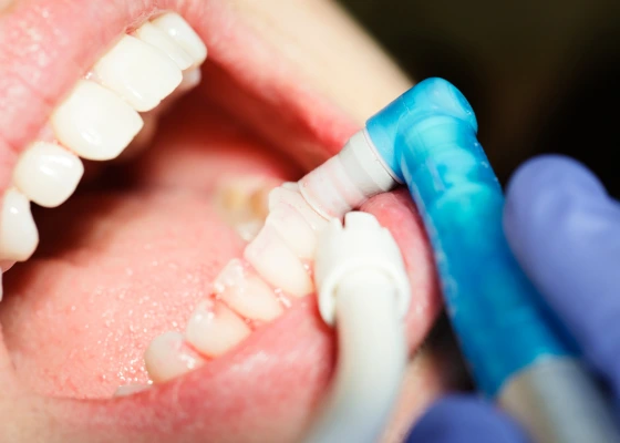 Pg Limpieza Dental Pro 2